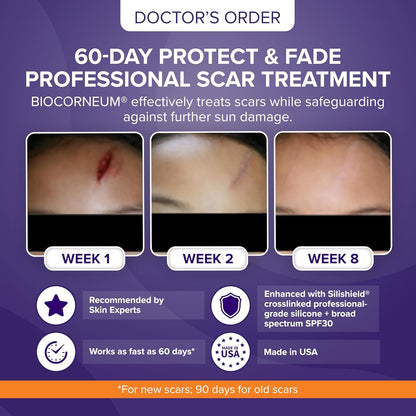 BIOCORNEUM + SPF 30, 10g