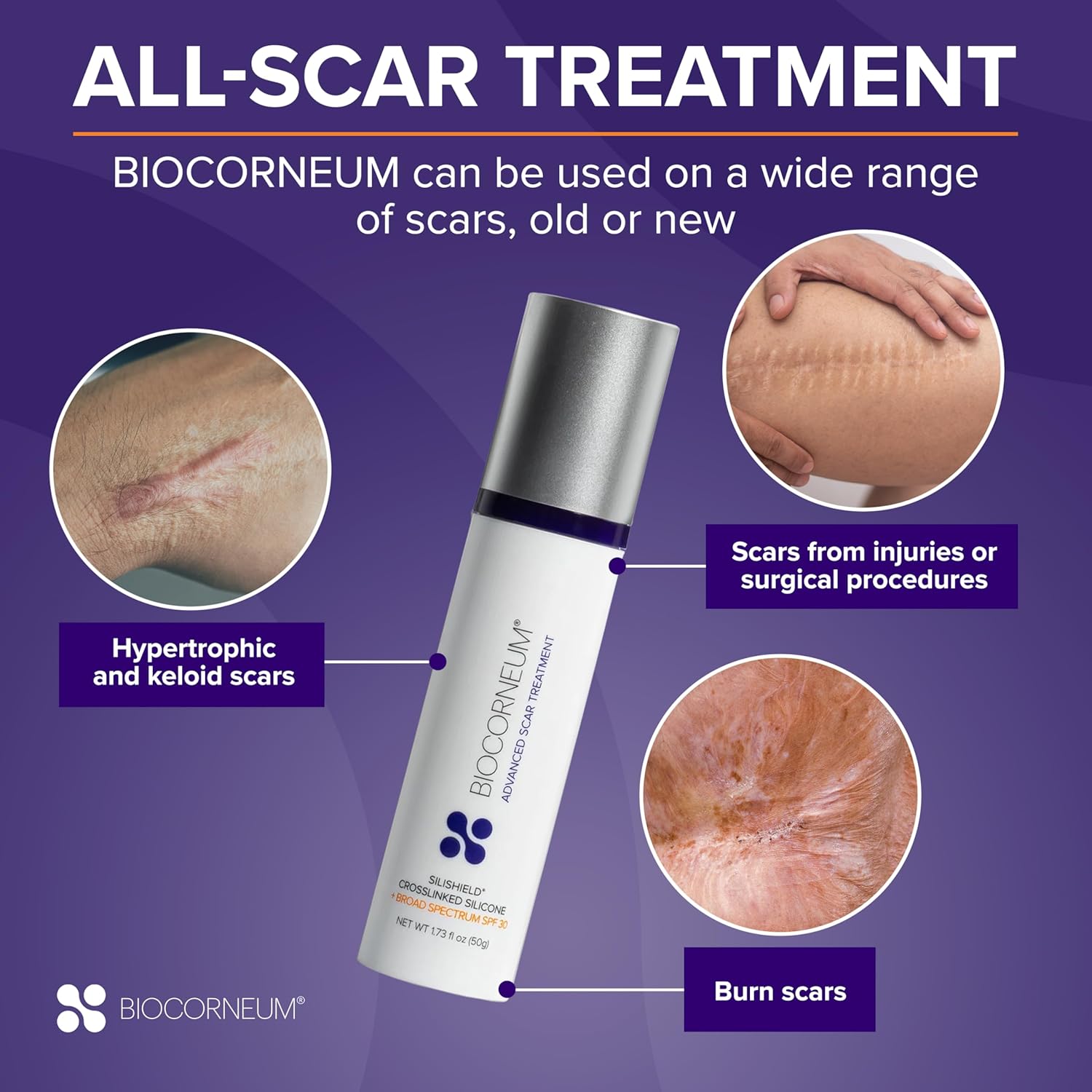 BIOCORNEUM + SPF 30, 10g